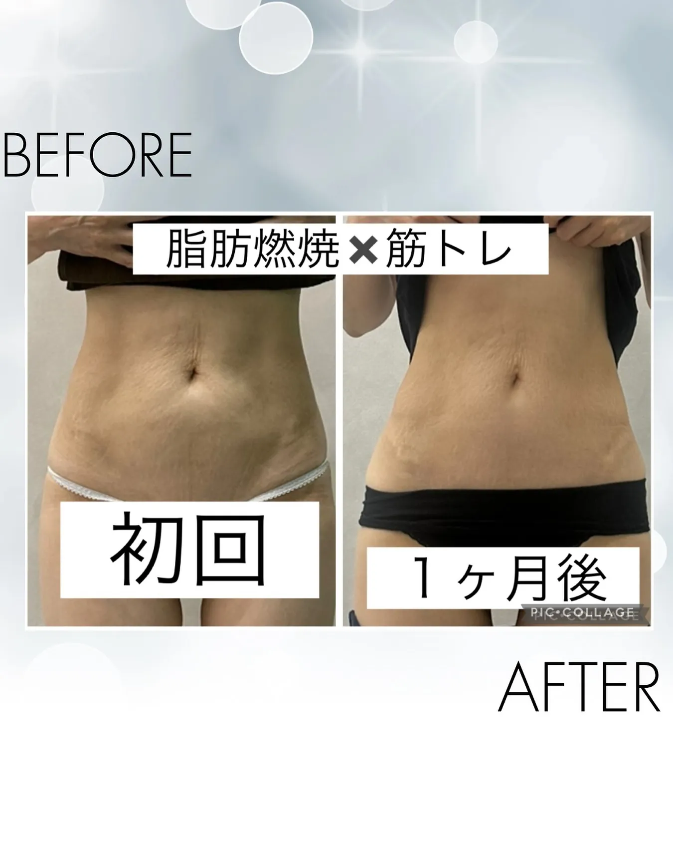 エムスレンダー1ヶ月(3日に1回/計8回)のbefore/a...