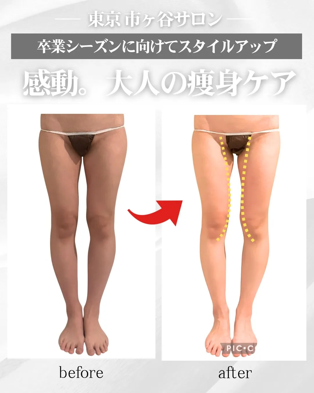 【新宿・市ヶ谷｜脚痩せ・太もも痩せ専門ケア】